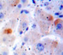 Used in DAB staining on fromalin fixed paraffin-embedded Liver tissue