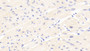 DABstainingonIHC-P.Samples:HumanTissue)