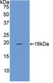 Western Blot; Sample: Recombinant PROCR, Rat.