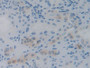 DAB staining on IHC-P; Samples: Human Kidney Tissue;  Primary Ab: 30µg/ml Mouse Anti-Human IL12A Ant