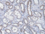 DAB staining on IHC-P; Samples: Human Kidney Tissue;  Primary Ab: 20µg/ml Mouse Anti-Human ICA1 Anti