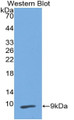 Western Blot; Sample: Recombinant protein.