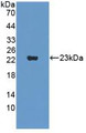 Western Blot; Sample: Recombinant SVIL, Human.