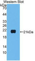 Western Blot; Sample: Recombinant IL1b, Human.