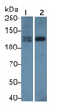 Western Blot; Sample: Lane1: MCF7 cell lysate; Lane2: Porcine Pancreas lysate; Primary Ab: 0.5µg/ml Mouse Anti-Human ISR Antibody; Second Ab: 0.2µg/mL HRP-Linked Caprine Anti-Mouse IgG Polyclonal Antibody;