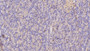 DAB staining on IHC-P; Samples: Human Pancreas Tissue; Primary Ab: 20µg/ml Mouse Anti-Human ISR Antibody Second Ab: 2µg/mL HRP-Linked Caprine Anti-Mouse IgG Polyclonal Antibody