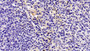 DAB staining on IHC-P; Samples: Human Kidney Tissue;  Primary Ab: 30µg/ml Mouse Anti-Human IL8 Antib