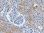 DAB staining on IHC-P; Samples: Human Kidney Tissue