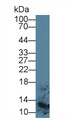 Western Blot; Sample: Human Lymphocyte lysate; Primary Ab: 5µg/ml Mouse Anti-Human S100A8 Antibody Second Ab: 0.2µg/mL HRP-Linked Caprine Anti-Mouse IgG Polyclonal Antibody