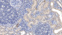 DAB staining on IHC-P; Samples: Human Kidney Tissue; Primary Ab: 20µg/ml Mouse Anti-Human LCAT Antibody Second Ab: 2µg/mL HRP-Linked Caprine Anti-Mouse IgG Polyclonal Antibody