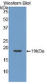 Western Blot; Sample: Recombinant protein.