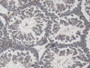 Figure. DAB staining on IHC-P; Samples: Mouse Testis Tissue.