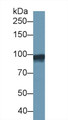 Western Blot; Sample: Human Lung lysate; Primary Ab: 2µg/ml Mouse Anti-Human GS Antibody Second Ab: 0.2µg/mL HRP-Linked Caprine Anti-Mouse IgG Polyclonal Antibody