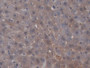 DAB staining on IHC-P; Samples: Rat Liver Tissue; Primary Ab: 20µg/ml Mouse Anti-Rat SHBG Antibody Second Ab: 2µg/mL HRP-Linked Caprine Anti-Mouse IgG Polyclonal Antibody