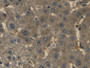 DAB staining on IHC-P; Samples: Human Liver Tissue;  Primary Ab: 30µg/ml Mouse Anti-Human Hpt Antibo