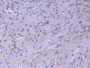 DAB staining on IHC-P; Samples: Human Prostate Tissue; Primary Ab: 20µg/ml Mouse Anti-Human HSPA1A Antibody Second Ab: 2µg/mL HRP-Linked Caprine Anti-Mouse IgG Polyclonal Antibody