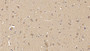 DAB staining on IHC-P; Samples: Human Cerebrum Tissue;  Primary Ab: 10µg/ml Mouse Anti-Human MMP25 Antibody Second Ab: 2µg/mL HRP-Linked Caprine Anti-Mouse IgG Polyclonal Antibody 