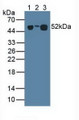 Western Blot; Sample: Lane1: Human Serum; Lane2: Porcine Heart Tissue; Lane3: Human Urine.