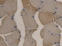 DAB staining on IHC-P; Samples: Rat Skeletal muscle Tissue; Primary Ab: 30µg/ml Mouse Anti-Rat APOB Antibody Second Ab: 2µg/mL HRP-Linked Caprine Anti-Mouse IgG Polyclonal Antibody