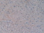 Figure. DAB staining on IHC-P; Samples: Human Liver Tissue.