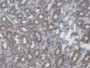 DAB staining on IHC-P; Samples: Mouse Kidney Tissue; Primary Ab: 20µg/ml Mouse Anti-Mouse FTH Antibody Second Ab: 2µg/mL HRP-Linked Caprine Anti-Mouse IgG Polyclonal Antibody