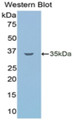 Western Blot; Sample: Recombinant protein.