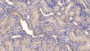 DAB staining on IHC-P; Samples: Human Kidney Tissue; Primary Ab: 20µg/ml Mouse Anti-Human SFRP1 Antibody Second Ab: 2µg/mL HRP-Linked Caprine Anti-Mouse IgG Polyclonal Antibody