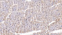 DAB staining on IHC-P; Samples: Human Cardiac Muscle Tissue;  Primary Ab: 20µg/ml Mouse Anti-Human SFRP1 Antibody Second Ab: 2µg/mL HRP-Linked Caprine Anti-Mouse IgG Polyclonal Antibody 
