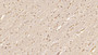 DAB staining on IHC-P; Samples: Human Cerebrum Tissue; Primary Ab: 40µg/ml Mouse Anti-Human CDNF Antibody Second Ab: 2µg/mL HRP-Linked Caprine Anti-Mouse IgG Polyclonal Antibody