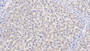 DAB staining on IHC-P; Samples: Human Liver Tissue; Primary Ab: 10µg/ml Mouse Anti-Human VDAC1 Antibody Second Ab: 2µg/mL HRP-Linked Caprine Anti-Mouse IgG Polyclonal Antibody