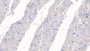 DAB staining on IHC-P; Samples: Human Heart Tissue; Primary Ab: 10µg/ml Mouse Anti-Human SEMA3A Antibody Second Ab: 2µg/mL HRP-Linked Caprine Anti-Mouse IgG Polyclonal Antibody