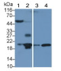 Western Blot; Sample: Recombinant IL1RA, Rabbit. Western Blot; Sample: Recombinant IL1RA, Rabbit.