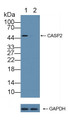 Knockout Varification: ; Lane 1: Wild-type Jurkat cell lysate; ; Lane 2: CASP2 knockout Jurkat cell lysate; ; Predicted MW: 10,35,51kd ; Observed MW: 51kd; Primary Ab: 1µg/ml Rabbit Anti-Human CASP2 Antibody; Second Ab: 0.2µg/mL HRP-Linked Caprine Anti-Rabbit IgG Polyclonal Antibody;