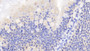 DAB staining on fromalin fixed paraffin- embedded kidney tissue)