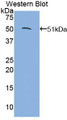 Western Blot; Sample: Recombinant protein.