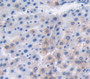 Used in DAB staining on fromalin fixed paraffin- embedded Kidney tissue