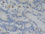 DAB staining on IHC-P; Samples: Human Stomach Tissue; Primary Ab: 10µg/ml Rabbit Anti-Human NR3C1 Antibody Second Ab: 2µg/mL HRP-Linked Caprine Anti-Rabbit IgG Polyclonal Antibody