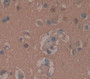 Chorionic Gonadotropin Alpha Polypeptide (CGa) Polyclonal Antibody, Cat#CAU29968