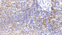 DAB staining on IHC-P; Samples: Rabbit Spleen Tissue;  Primary Ab: 10μg/ml Cavia Anti-Rabbit MHCDRa Antibody Second Ab: 2µg/mL HRP-Linked Rabbit Anti-Cavia IgG Polyclonal Antibody 