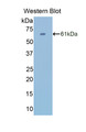 Western Blot; Sample: Recombinant protein.