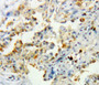 Used in DAB staining on fromalin fixed paraffin-embedded lung tissue