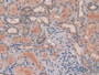 DAB staining on IHC-P; Samples: Human Kidney Tissue; Primary Ab: 20µg/ml Rabbit Anti-Human PTEN Antibody Second Ab: 2µg/mL HRP-Linked Caprine Anti-Rabbit IgG Polyclonal Antibody