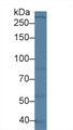 Western Blot; Sample: Human Lung lysate; ;Primary Ab: 2µg/ml Rabbit Anti-Human LRRK2 Antibody;Second Ab: 0.2µg/mL HRP-Linked Caprine Anti-Rabbit IgG Polyclonal Antibody;