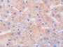 DAB staining on IHC-P; Samples: Human Liver Tissue;  Primary Ab: 30µg/ml Rabbit Anti-Human LRRK2 Ant