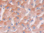 DAB staining on IHC-P; Samples: Human Liver Tissue; Primary Ab: 30µg/ml Rabbit Anti-Human LRRK2 Antibody Second Ab: 2µg/mL HRP-Linked Caprine Anti-Rabbit IgG Polyclonal Antibody