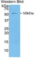 Western Blot; Sample: Recombinant protein.