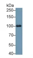 Aconitase 1 (ACO1) Polyclonal Antibody, CAU30000