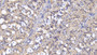 DAB staining on IHC-P; Samples: Human Stomach Tissue; Primary Ab: 10µg/ml Mouse Anti-Human IL1RA Antibody Second Ab: 2µg/mL HRP-Linked Caprine Anti-Mouse IgG Polyclonal Antibody