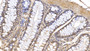 DAB staining on IHC-P; Samples: Human Colon Tissue; Primary Ab: 10µg/ml Mouse Anti-Human IL1RA Antibody Second Ab: 2µg/mL HRP-Linked Caprine Anti-Mouse IgG Polyclonal Antibody