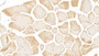 DAB staining on IHC-P; Samples: Human Skeletal muscle Tissue; Primary Ab: 10µg/ml Mouse Anti-Human TNNI3 Antibody Second Ab: 2µg/mL HRP-Linked Caprine Anti-Mouse IgG Polyclonal Antibody